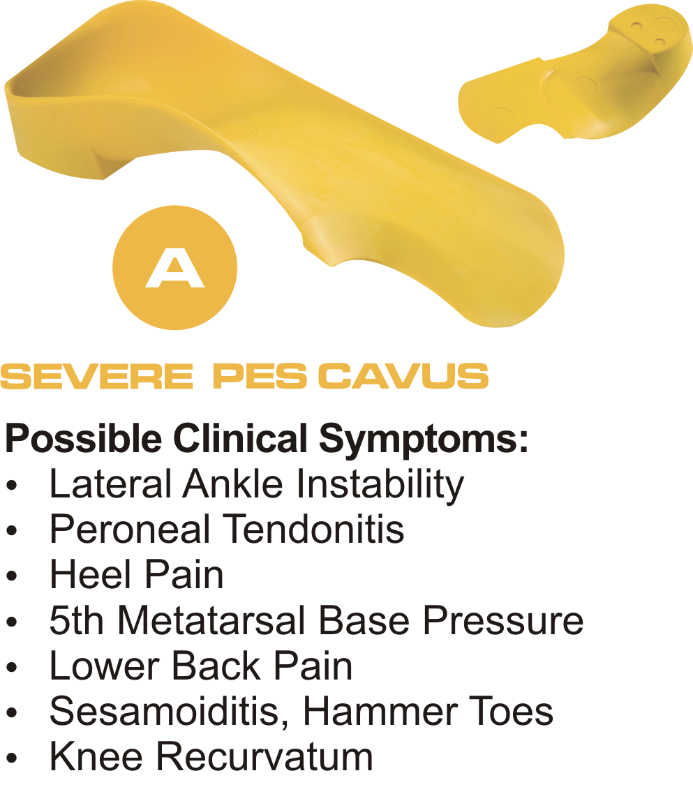 QUADRASTEP® Foot Orthotics A Quad Freed Foot