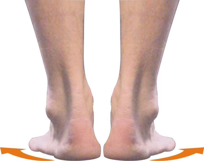 QUADRASTEP® Foot Orthotics C Quad Freed Foot